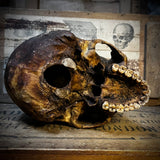 Human skull