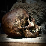 Human skull with mandible