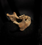 A mandible