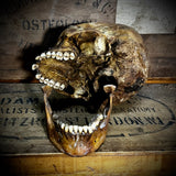 Human skull with mandible