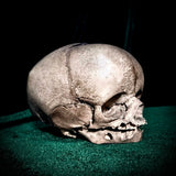 Human fetal skull