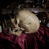 Adam Rouilly medical skull