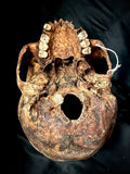 A human skull