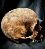 A human skull