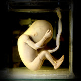 Foetal specimen