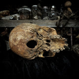 Human skull