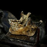 A mandible