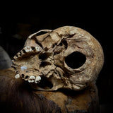 Human skull