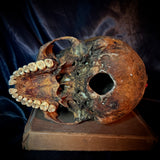 Item 7. Human skull