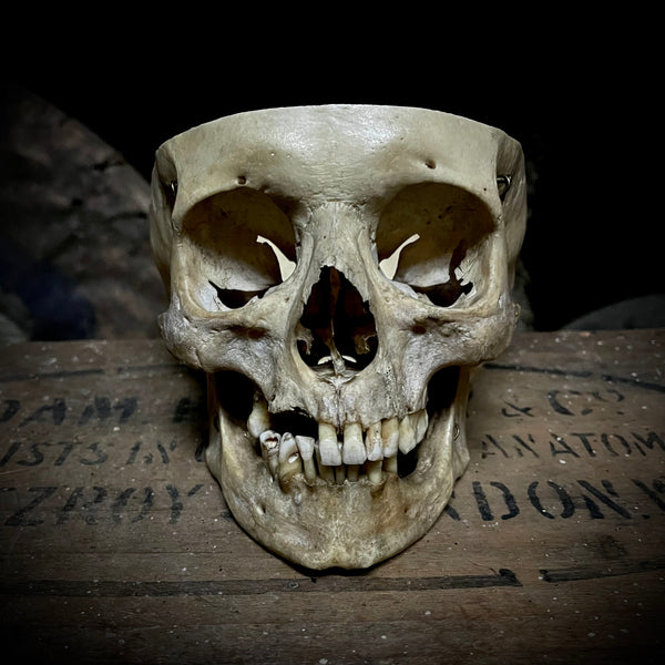 Partial medically prepared human skull