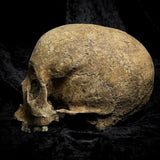 Human skull