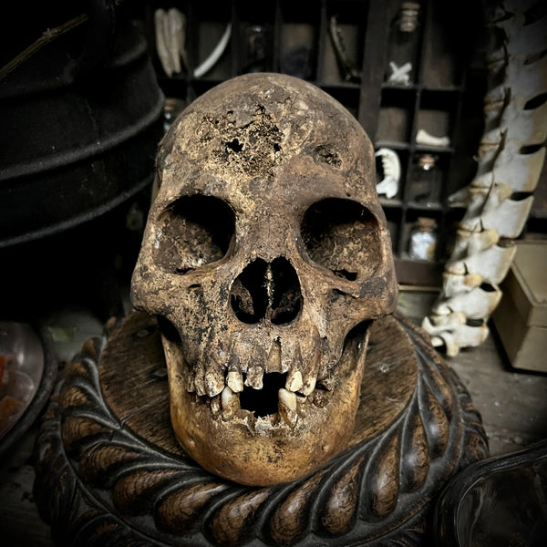 Human skull with mandible