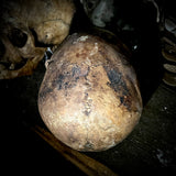 Human skull with mandible