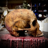 Human skull