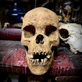 Human skull with mandible