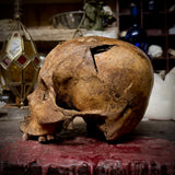 Human skull with trauma