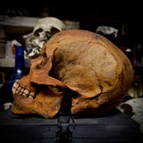 Human skull with mandible