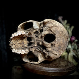 A human skull