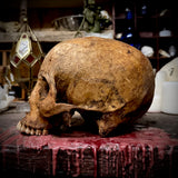 Human skull