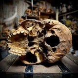 Human skull