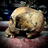 Human skull
