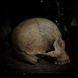 Human skull