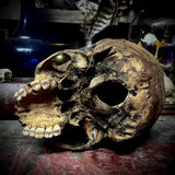 Human skull