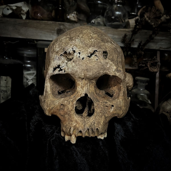 Human skull