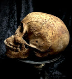 A human skull with mandible