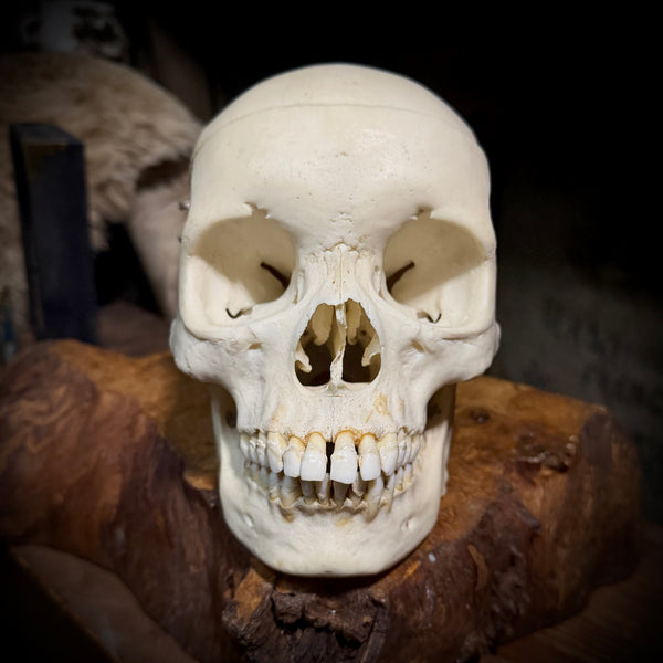 Medically prepared human skull