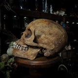 Human skull