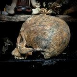 Human skull