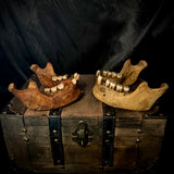 Item 7. A pair of human mandibles