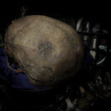 Human skull