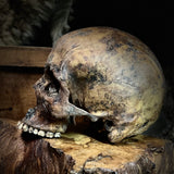 Human skull