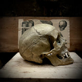 A human medical skull