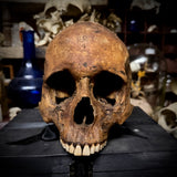 Human skull