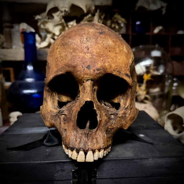 Human skull