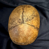 Item 9. Human skull cap
