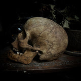 Human skull