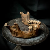 A mandible