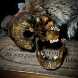Human skull with mandible