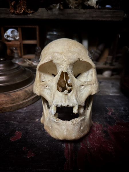 Medically prepared human skull