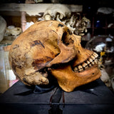 Human skull with mandible