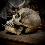 Human skull with mandible