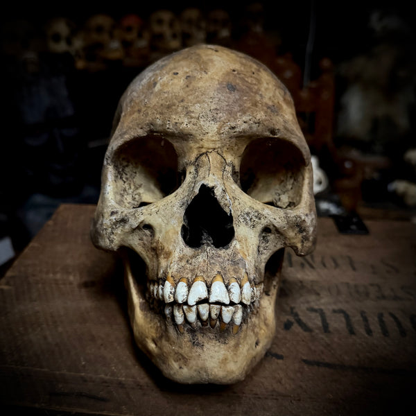 Human skull with mandible