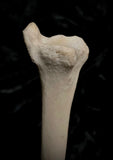 Human tibia (shinbone)