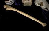Human ulna