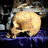 Human skull