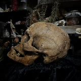 Human skull